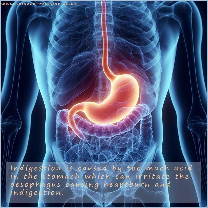 Indigestion is caused by the stomach producing too much acid.